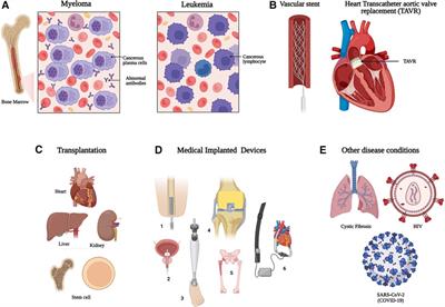 Radiometal chelators for infection diagnostics